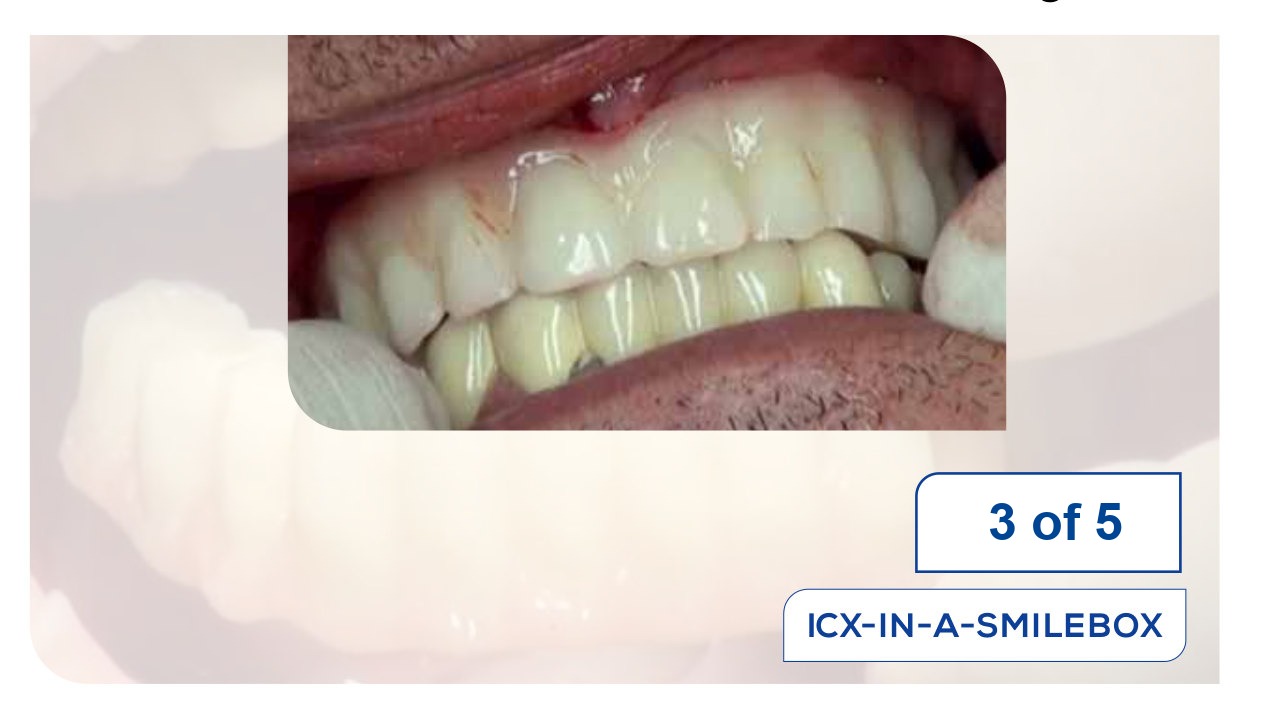 ICX-IN-A-SMILEBOX system